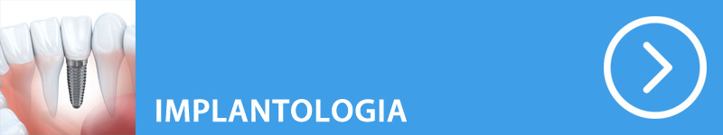 800-150-implantologia